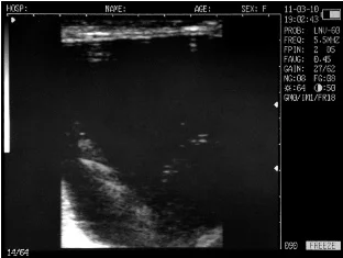 Sonovet ultrasound Scanner Sonovet ultrasound Scanner