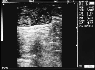 Sonovet ultrasound Scanner Sonovet ultrasound Scanner