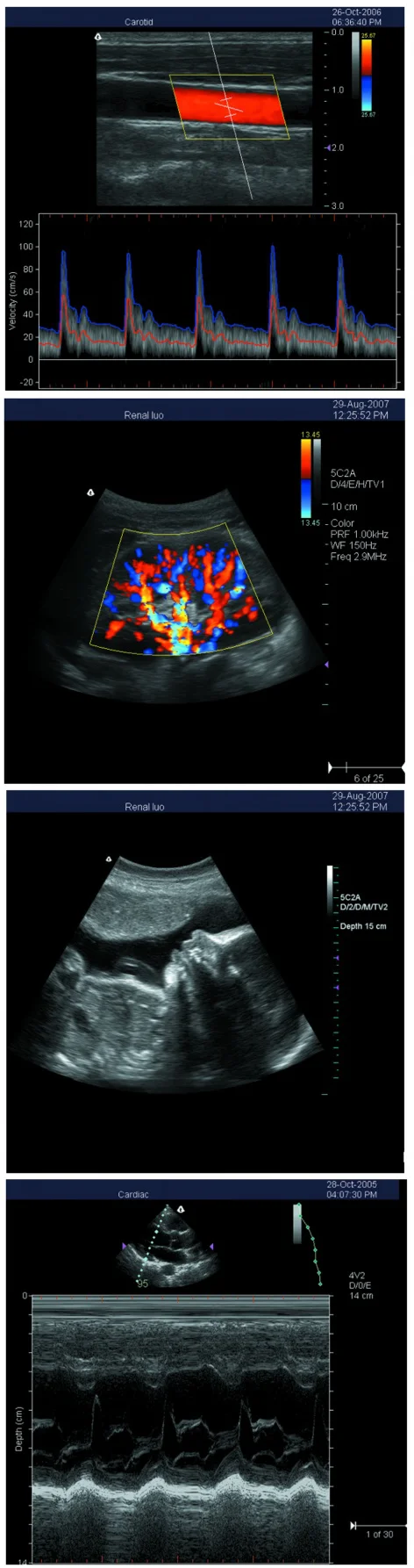 S5i ultrasound Scanner S5i ultrasound Scanner